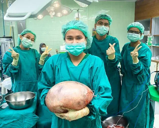 Unexpected Discovery: Thai Woman's 'Fat Belly' Found to Be a 17-Pound Ovarian Cyst