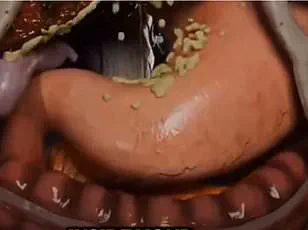 Urgent Health Warning: 'Proffee' Trend Sparks Concerns Over Weight Gain and Dietary Imbalance