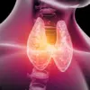 The Hidden Health Crisis: Thyroid Disease and Its Impact on the UK Public